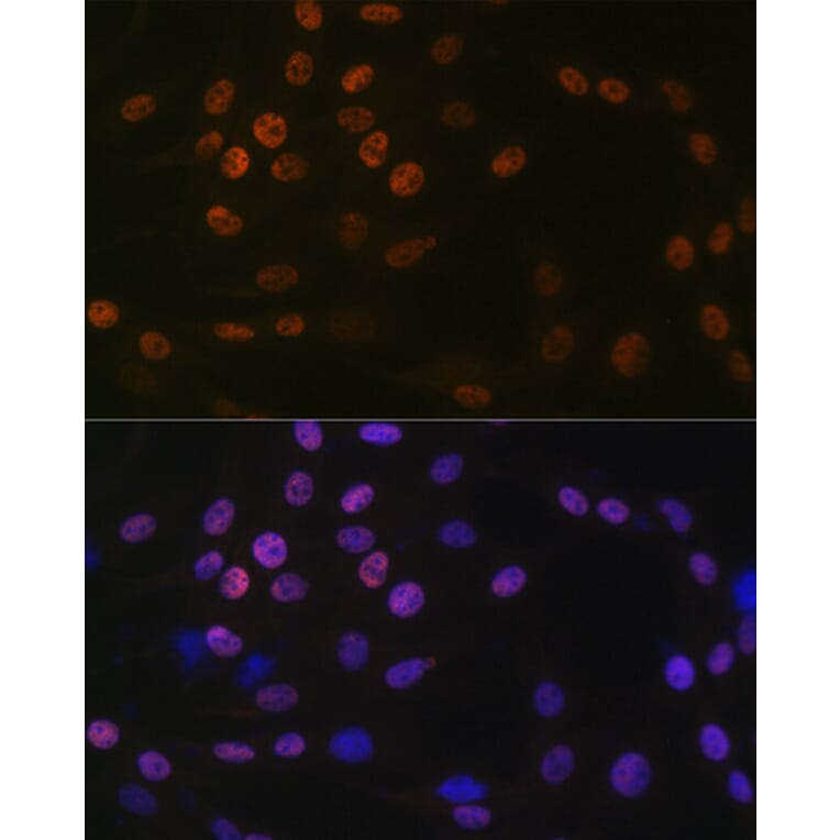Immunofluorescence - Anti-KAT1/HAT1 Antibody [ARC1002] (A306252) - Antibodies.com