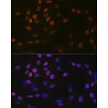 Immunofluorescence - Anti-KAT1/HAT1 Antibody [ARC1002] (A306252) - Antibodies.com