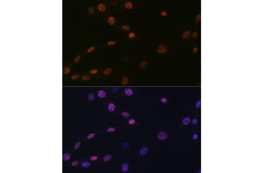 Immunofluorescence - Anti-KAT1/HAT1 Antibody [ARC1002] (A306252) - Antibodies.com