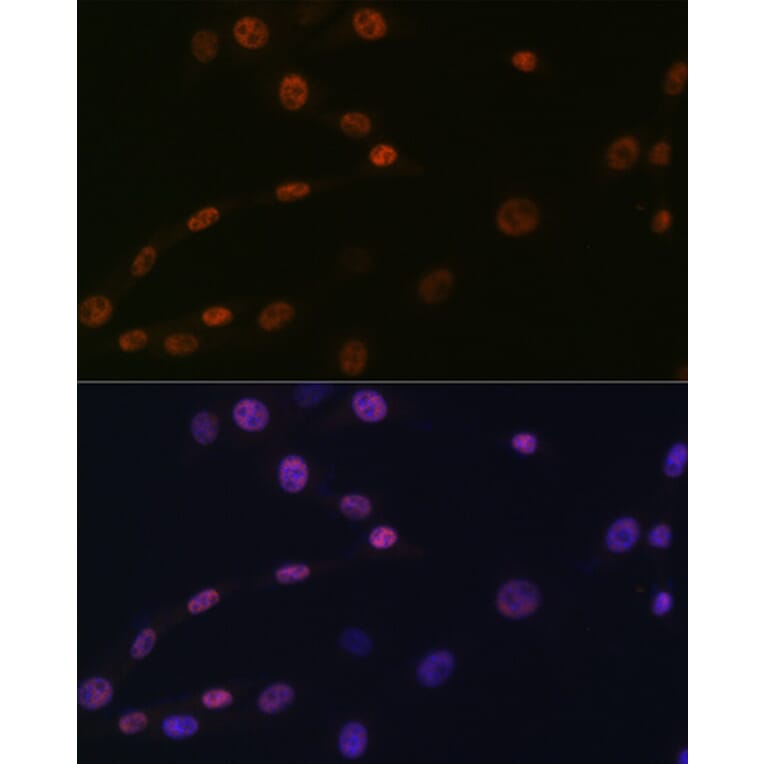 Immunofluorescence - Anti-KAT1/HAT1 Antibody [ARC1002] (A306252) - Antibodies.com