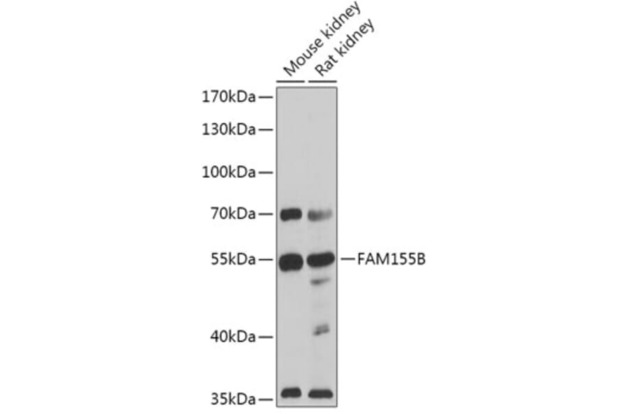 Western Blot - Anti-NALF2 Antibody (A306253) - Antibodies.com