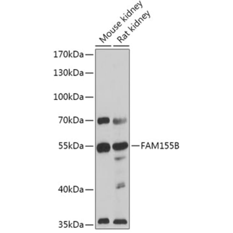Western Blot - Anti-NALF2 Antibody (A306253) - Antibodies.com