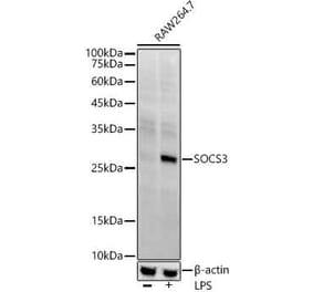 Western Blot - Anti-SOCS3 Antibody [ARC53312] (A306254) - Antibodies.com