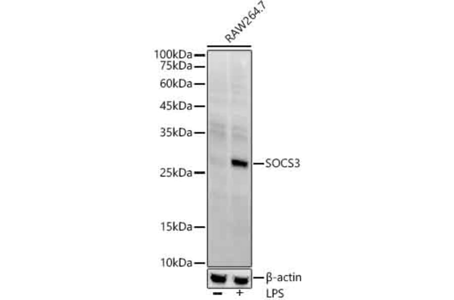 Western Blot - Anti-SOCS3 Antibody [ARC53312] (A306254) - Antibodies.com