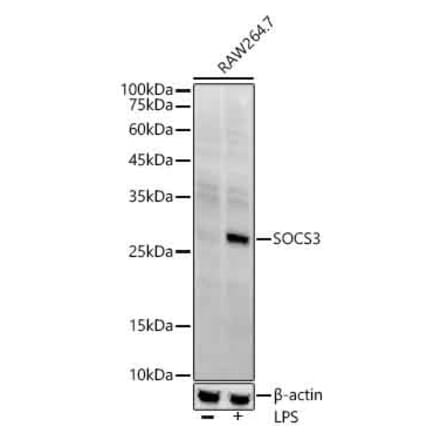 Western Blot - Anti-SOCS3 Antibody [ARC53312] (A306254) - Antibodies.com