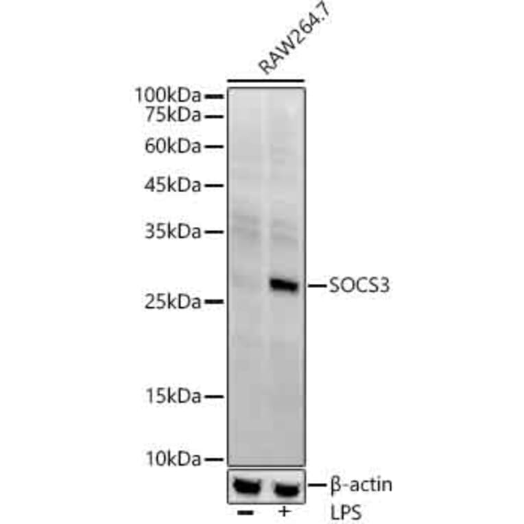 Western Blot - Anti-SOCS3 Antibody [ARC53312] (A306254) - Antibodies.com