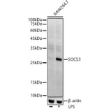 Western Blot - Anti-SOCS3 Antibody [ARC53312] (A306254) - Antibodies.com