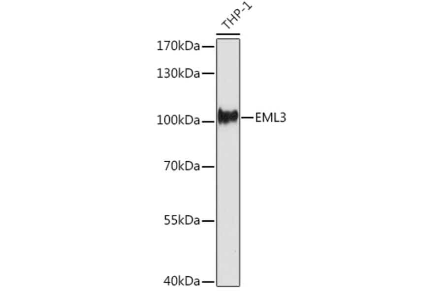 Western Blot - Anti-EML3 Antibody (A306255) - Antibodies.com