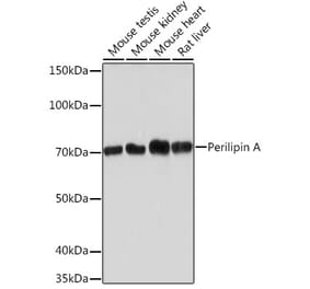Western Blot - Anti-Perilipin-1 Antibody [ARC1122] (A306256) - Antibodies.com
