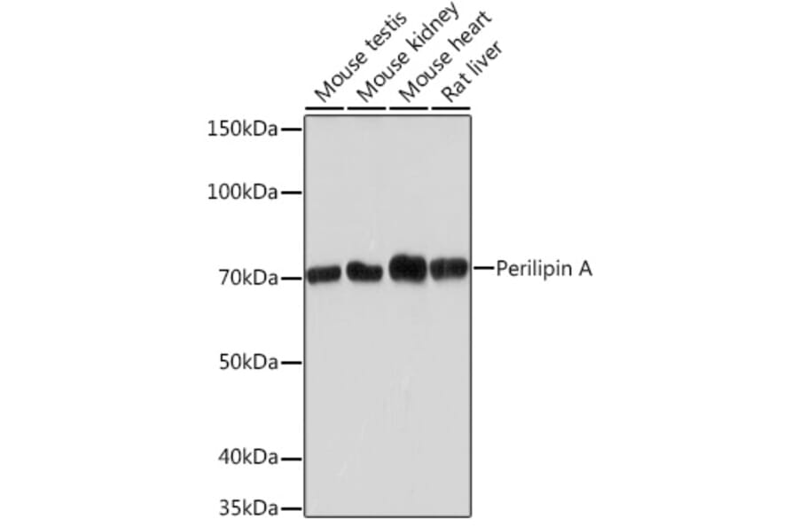 Western Blot - Anti-Perilipin-1 Antibody [ARC1122] (A306256) - Antibodies.com