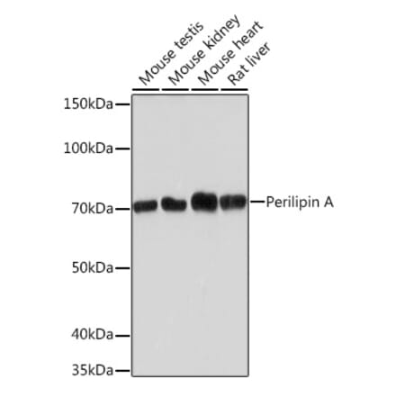 Western Blot - Anti-Perilipin-1 Antibody [ARC1122] (A306256) - Antibodies.com