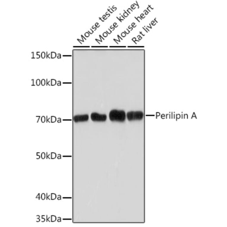 Western Blot - Anti-Perilipin-1 Antibody [ARC1122] (A306256) - Antibodies.com