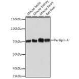 Western Blot - Anti-Perilipin-1 Antibody [ARC1122] (A306256) - Antibodies.com