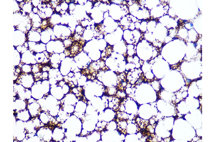 Immunohistochemistry - Anti-Perilipin-1 Antibody [ARC1122] (A306256) - Antibodies.com