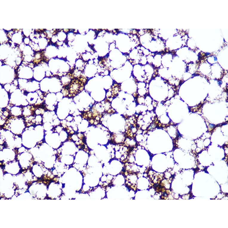 Immunohistochemistry - Anti-Perilipin-1 Antibody [ARC1122] (A306256) - Antibodies.com