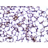 Immunohistochemistry - Anti-Perilipin-1 Antibody [ARC1122] (A306256) - Antibodies.com