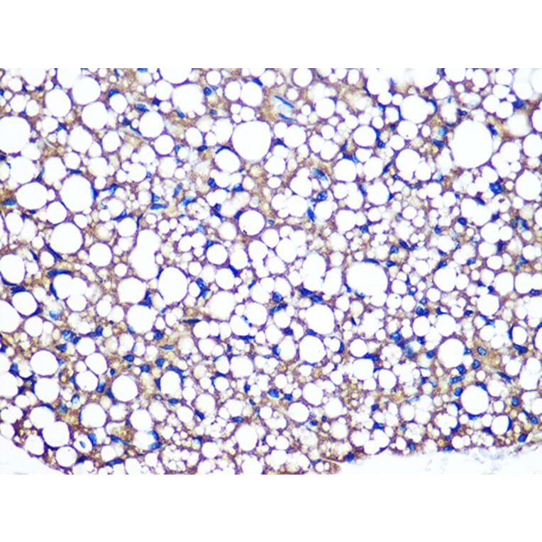 Immunohistochemistry - Anti-Perilipin-1 Antibody [ARC1122] (A306256) - Antibodies.com