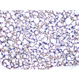 Immunohistochemistry - Anti-Perilipin-1 Antibody [ARC1122] (A306256) - Antibodies.com
