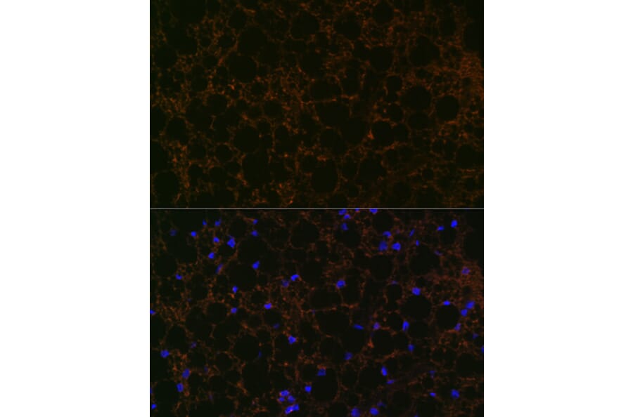 Immunofluorescence - Anti-Perilipin-1 Antibody [ARC1122] (A306256) - Antibodies.com