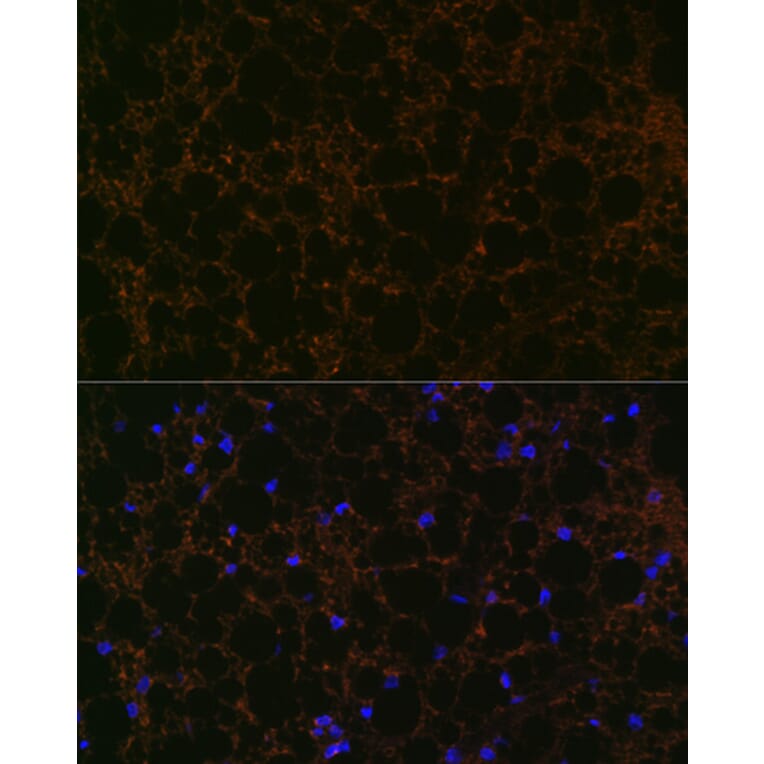 Immunofluorescence - Anti-Perilipin-1 Antibody [ARC1122] (A306256) - Antibodies.com
