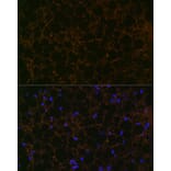 Immunofluorescence - Anti-Perilipin-1 Antibody [ARC1122] (A306256) - Antibodies.com