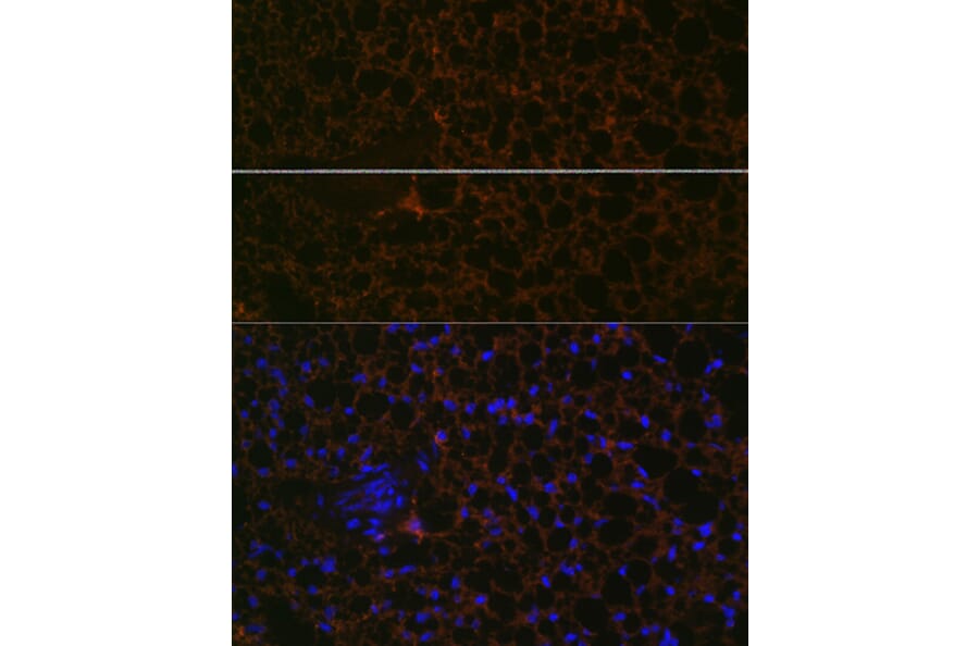 Immunofluorescence - Anti-Perilipin-1 Antibody [ARC1122] (A306256) - Antibodies.com