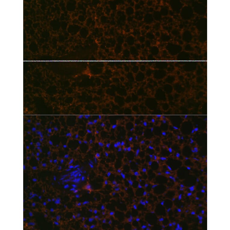 Immunofluorescence - Anti-Perilipin-1 Antibody [ARC1122] (A306256) - Antibodies.com