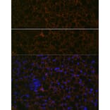 Immunofluorescence - Anti-Perilipin-1 Antibody [ARC1122] (A306256) - Antibodies.com