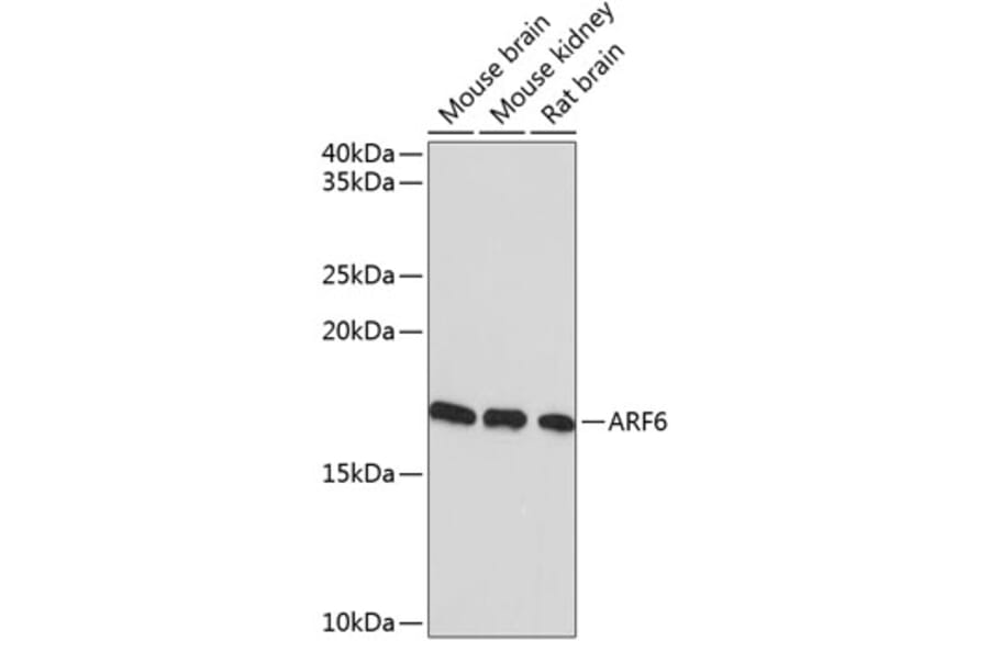 Western Blot - Anti-ARF6 Antibody [ARC0617] (A306257) - Antibodies.com
