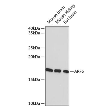 Western Blot - Anti-ARF6 Antibody [ARC0617] (A306257) - Antibodies.com