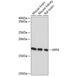 Western Blot - Anti-ARF6 Antibody [ARC0617] (A306257) - Antibodies.com