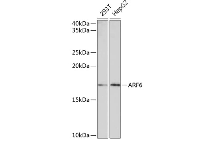 Western Blot - Anti-ARF6 Antibody [ARC0617] (A306257) - Antibodies.com