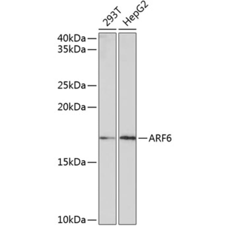 Western Blot - Anti-ARF6 Antibody [ARC0617] (A306257) - Antibodies.com