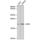 Western Blot - Anti-ARF6 Antibody [ARC0617] (A306257) - Antibodies.com