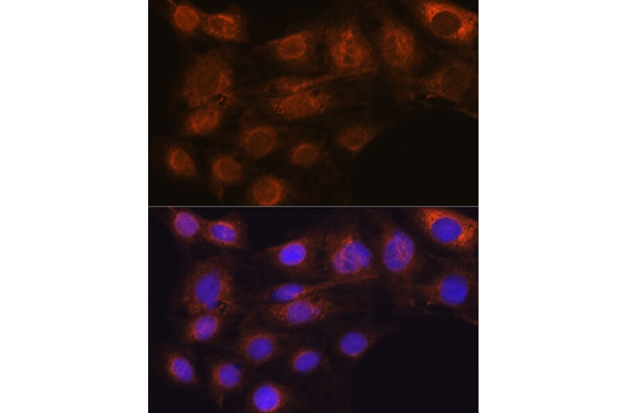 Immunofluorescence - Anti-ARF6 Antibody [ARC0617] (A306257) - Antibodies.com