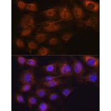 Immunofluorescence - Anti-ARF6 Antibody [ARC0617] (A306257) - Antibodies.com