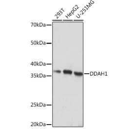 Western Blot - Anti-DDAH1 Antibody [ARC1043] (A306259) - Antibodies.com