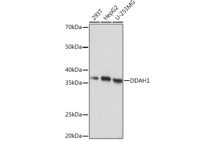 Western Blot - Anti-DDAH1 Antibody [ARC1043] (A306259) - Antibodies.com