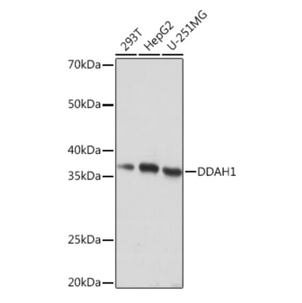 Western Blot - Anti-DDAH1 Antibody [ARC1043] (A306259) - Antibodies.com