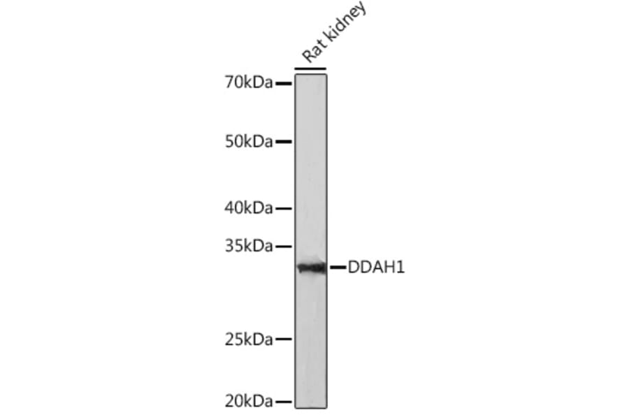 Western Blot - Anti-DDAH1 Antibody [ARC1043] (A306259) - Antibodies.com