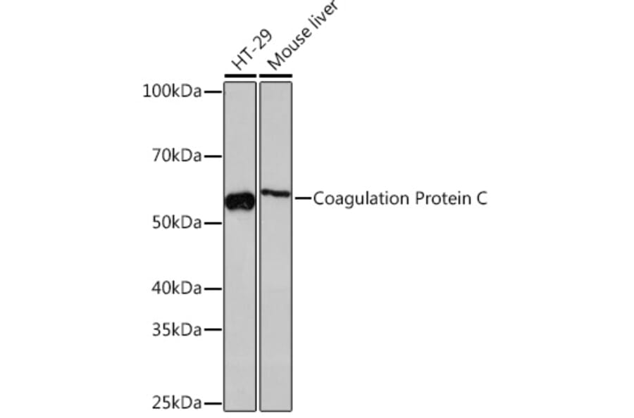 Western Blot - Anti-Protein C Antibody [ARC1023] (A306260) - Antibodies.com