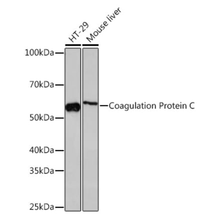 Western Blot - Anti-Protein C Antibody [ARC1023] (A306260) - Antibodies.com