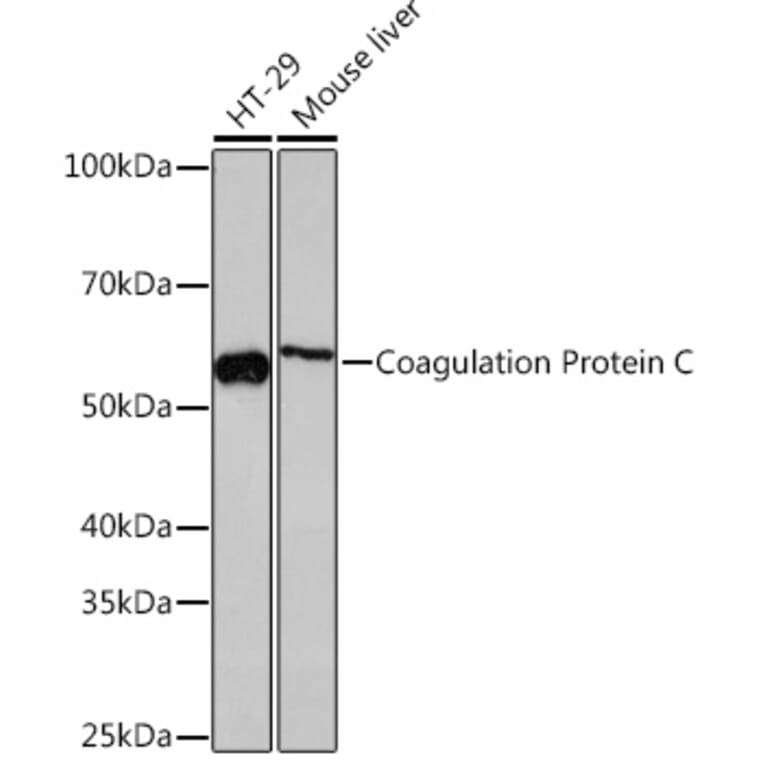 Western Blot - Anti-Protein C Antibody [ARC1023] (A306260) - Antibodies.com