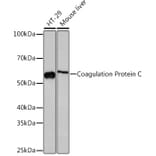 Western Blot - Anti-Protein C Antibody [ARC1023] (A306260) - Antibodies.com