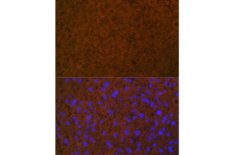 Immunofluorescence - Anti-Protein C Antibody [ARC1023] (A306260) - Antibodies.com