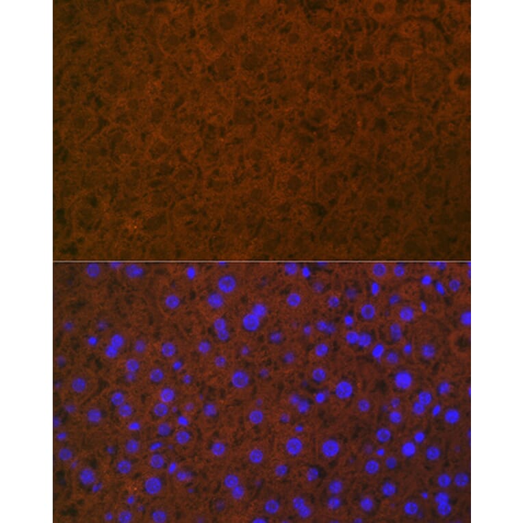Immunofluorescence - Anti-Protein C Antibody [ARC1023] (A306260) - Antibodies.com