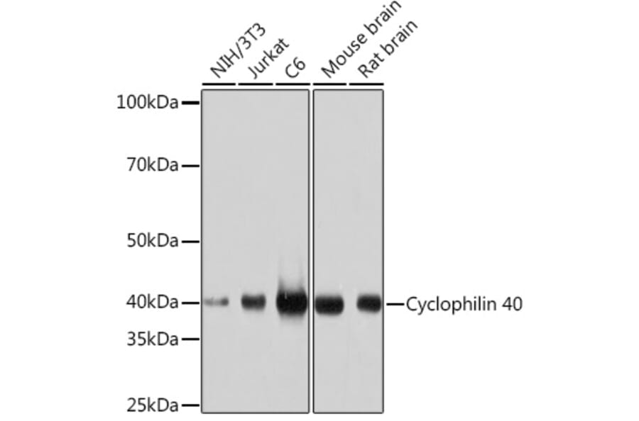 Western Blot - Anti-Cyclophilin 40 Antibody [ARC1260] (A306261) - Antibodies.com