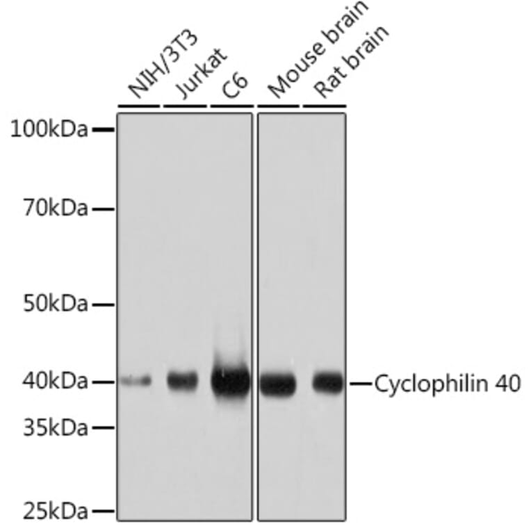 Western Blot - Anti-Cyclophilin 40 Antibody [ARC1260] (A306261) - Antibodies.com