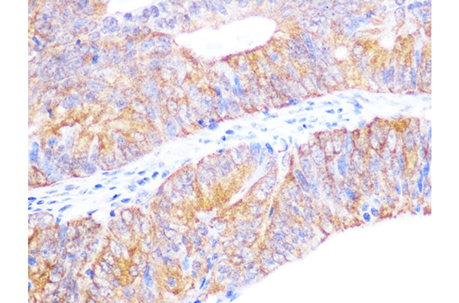 Immunohistochemistry - Anti-Cyclophilin 40 Antibody [ARC1260] (A306261) - Antibodies.com
