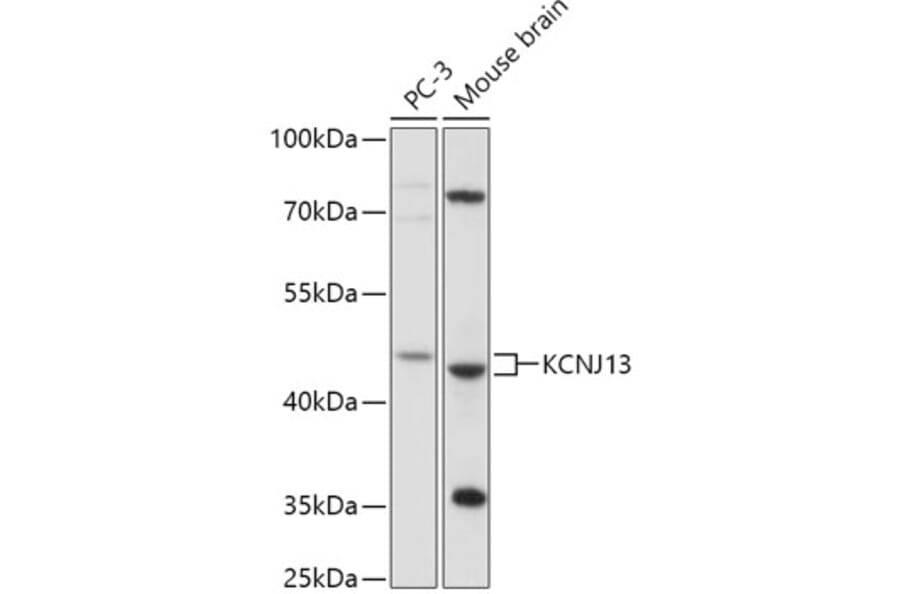 Western Blot - Anti-KCNJ13 Antibody (A306262) - Antibodies.com